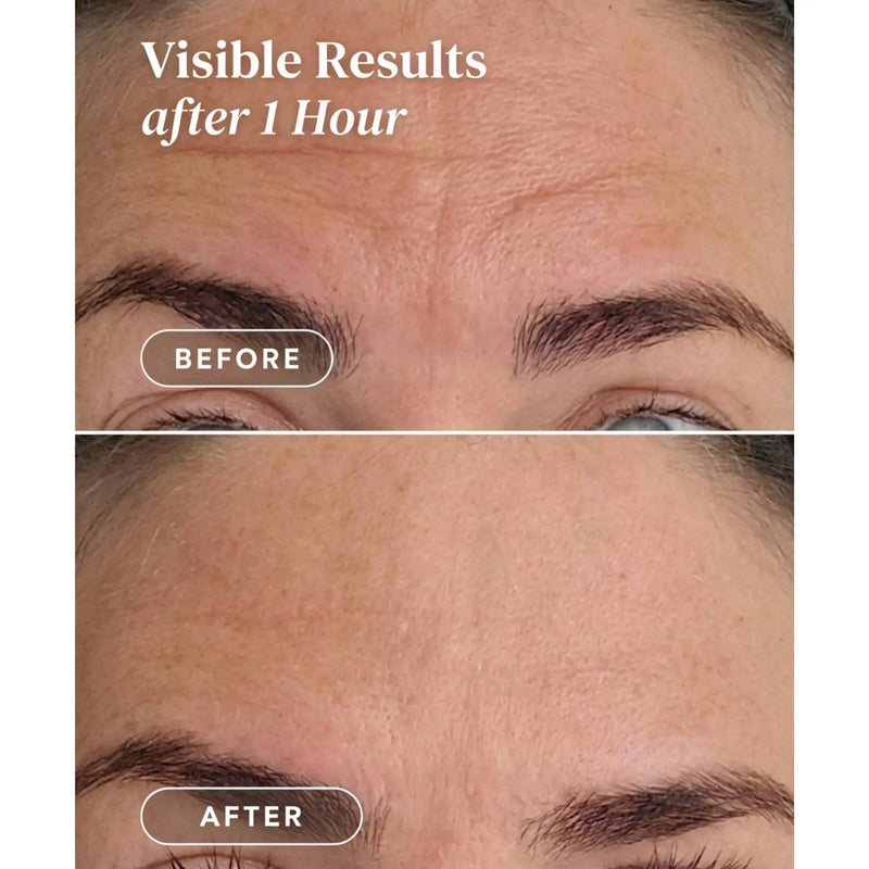 Apricot Beauty Forehead Pad Ectoin
