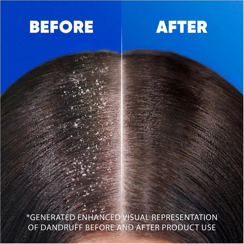Head & Shoulders Classic Clean Shampoo Mini