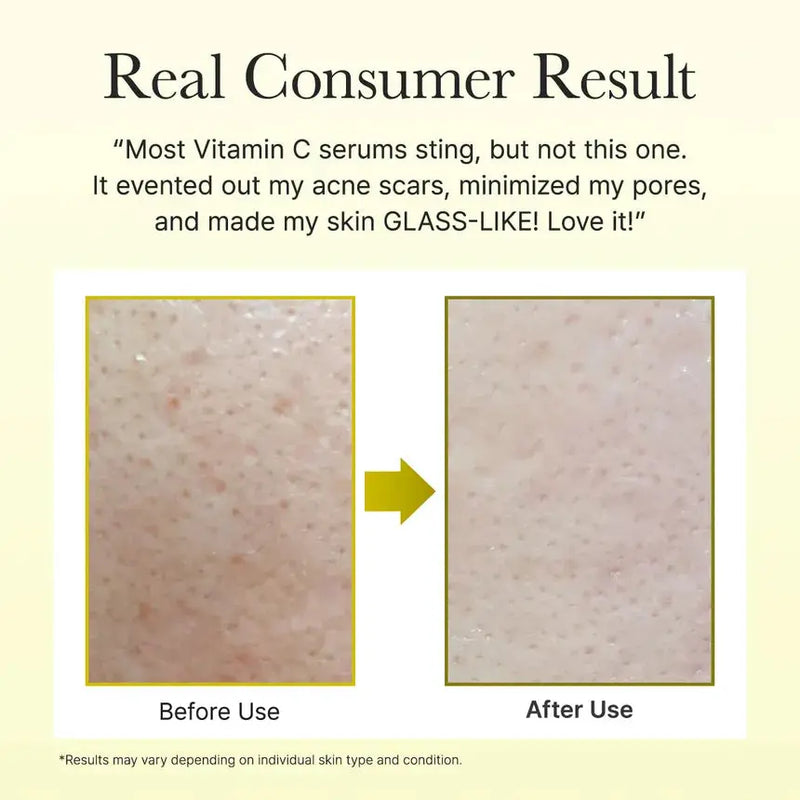 Arencia Vitamin C Booster Shot Mini