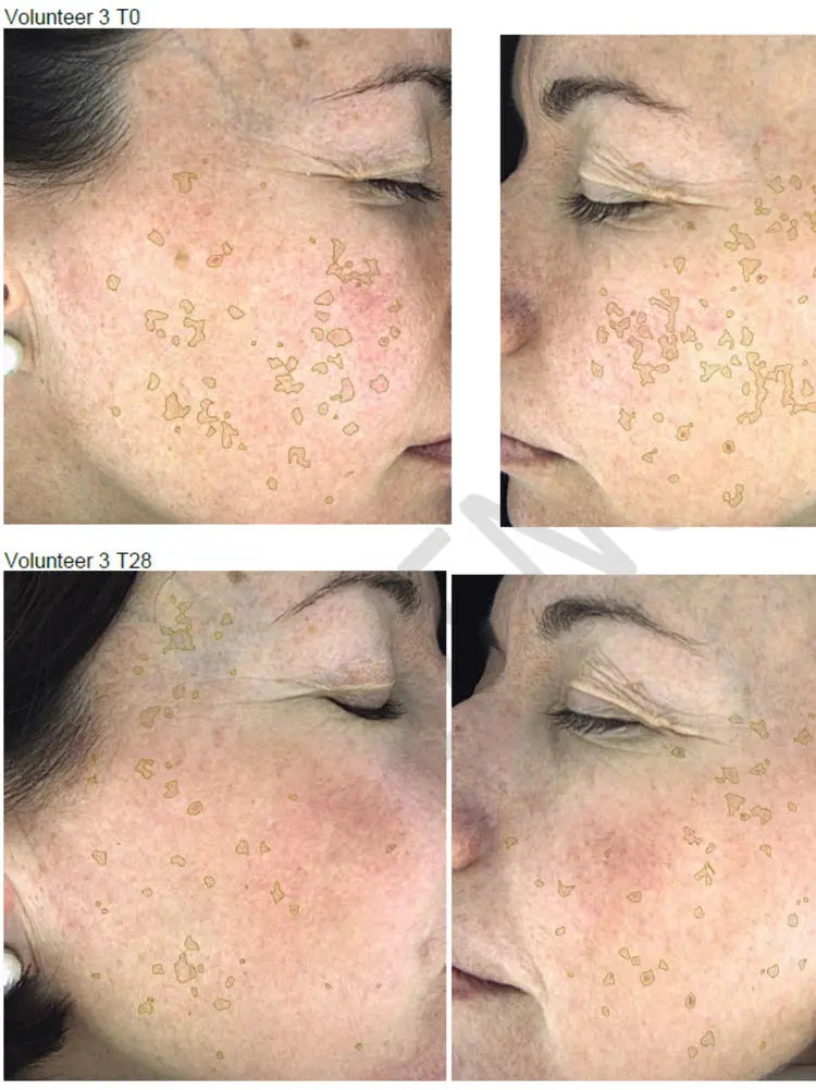 NERDS Hyperpigmentation Serum - 2% Alpha Arbutin + 1% Kojic Acid