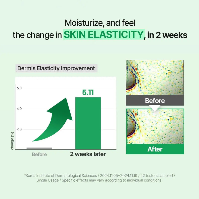Zipiderm Egf Skin Barrier Intensive Cream 80 ml.