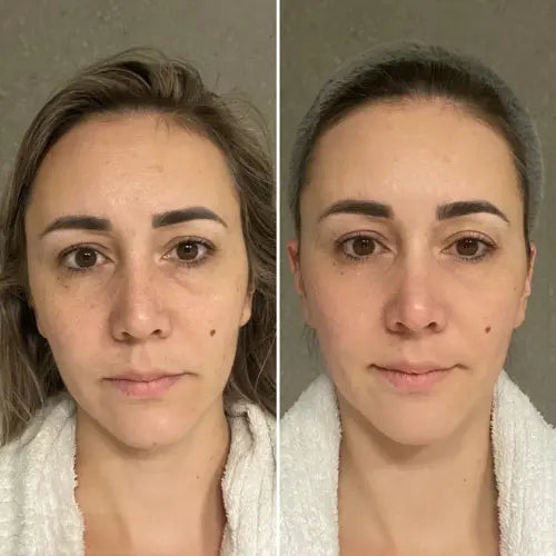 Bbody Tripeptide Collagen